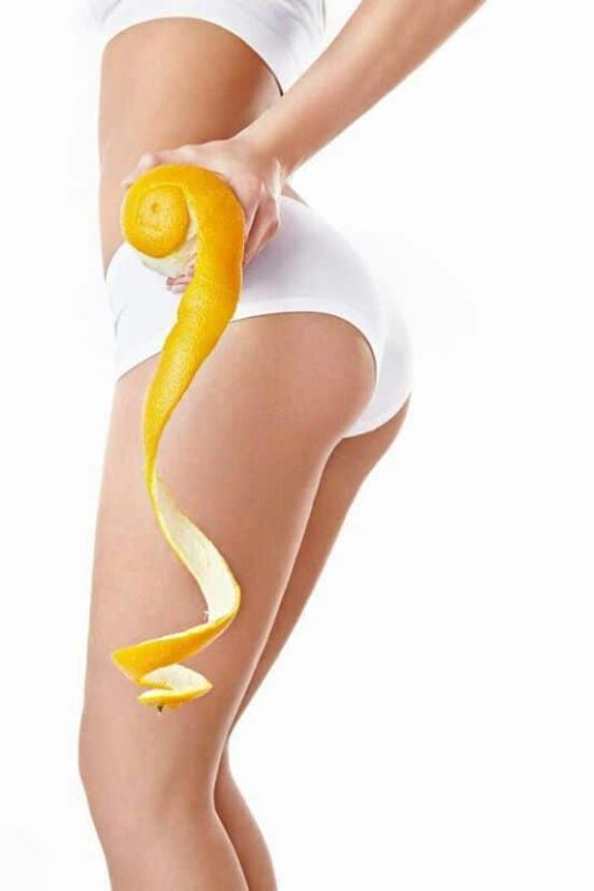 Combatir la celulitis