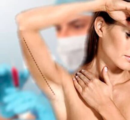 braquioplastia,-que-resultados-consigue braquioplastia,-que-resultados-consigue