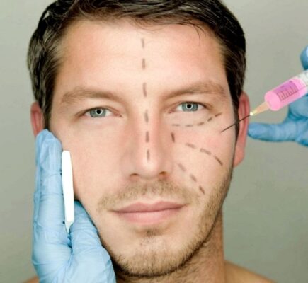 Medicina Estetica | Armonía facial hombre