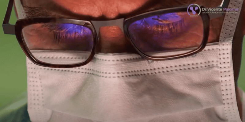 Feminizacion facial con reducción de frente | Dr. Vicente Paloma