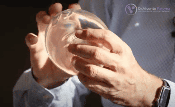 Protesis mamaria transparente | Dr. Vicente Paloma