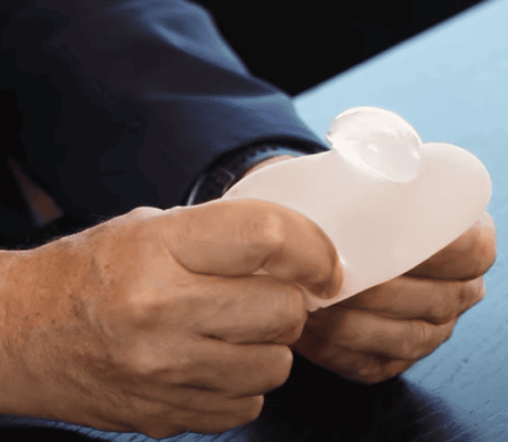 Dr. Vicente Paloma | Los sintomas de una rotura de protesis mamaria