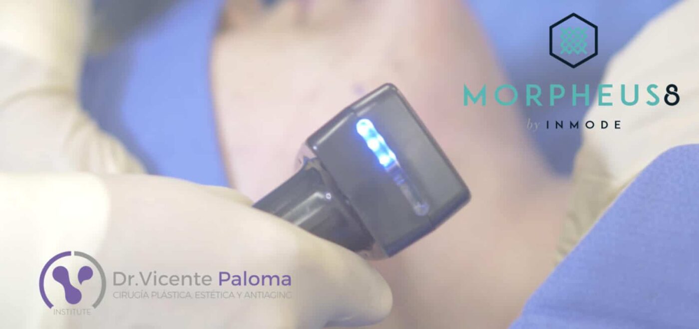Morpheus8 | Dr. Vicente Paloma