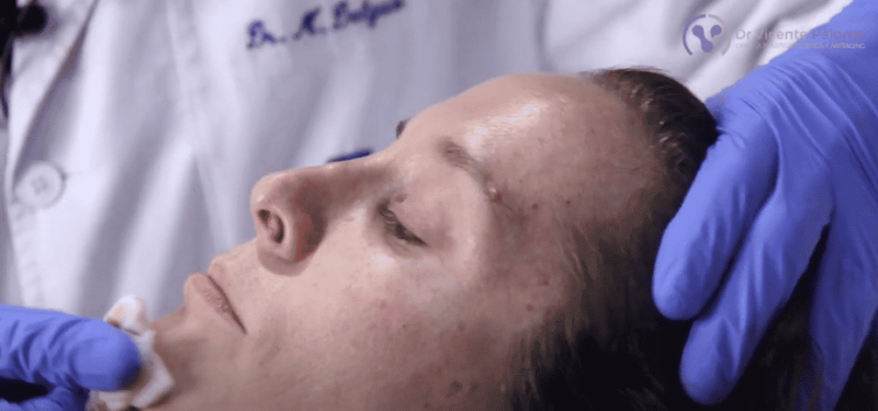 Tipos Relleno Dermico | Medicina estetica