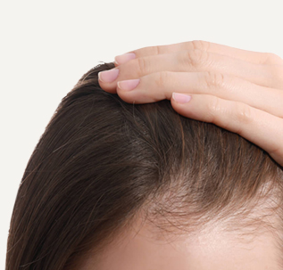 Tratamientos capilares mujeres en Barcelona