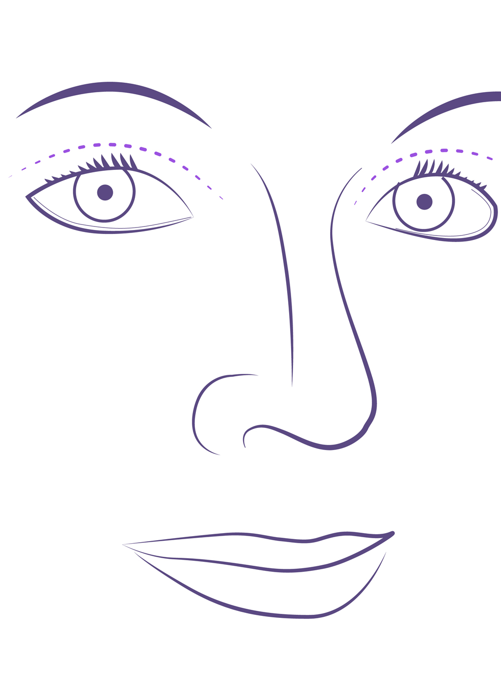 Incisiones cirugía de párpados caídos y bolsas