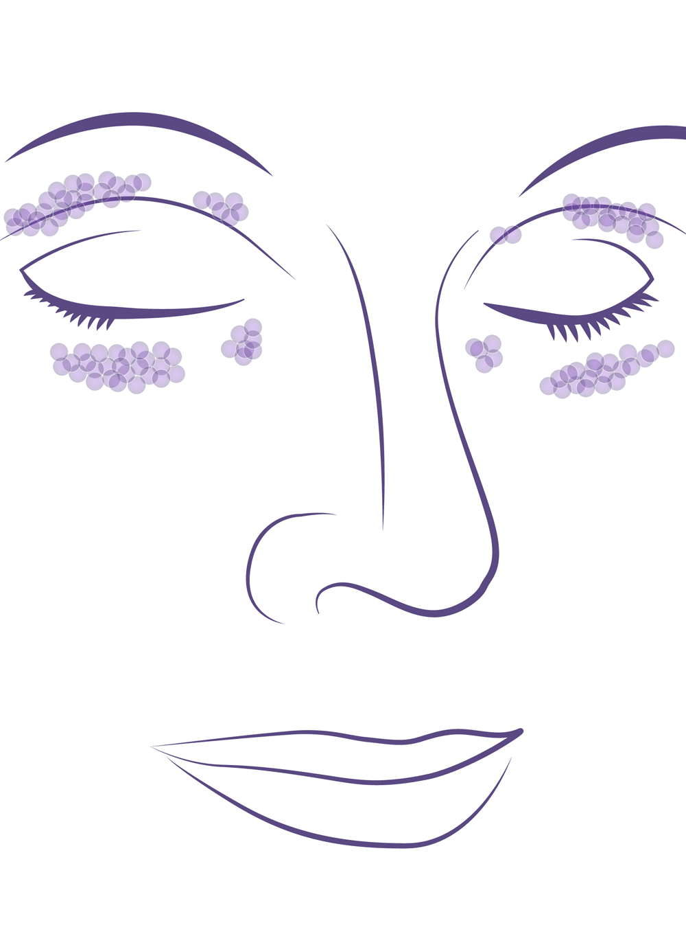 Grasa y exceso de piel en párpados superiores e inferiores.