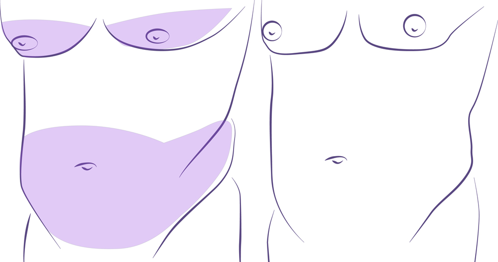 Liposucción barriga antes y después.