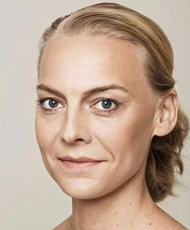 Skinbooster antes y después