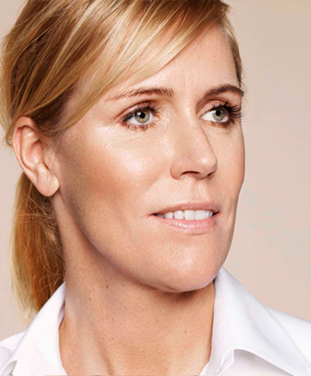 Skinbooster facial antes y después