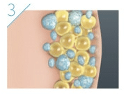 CoolSculpting proceso: el cuerpo libera de forma natural la grasa