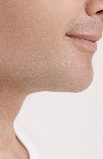 Lifting cuello después