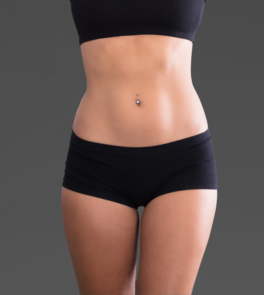 Mesoterapia corporal después 