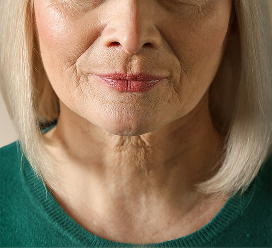 Mesoterapia facial antes 