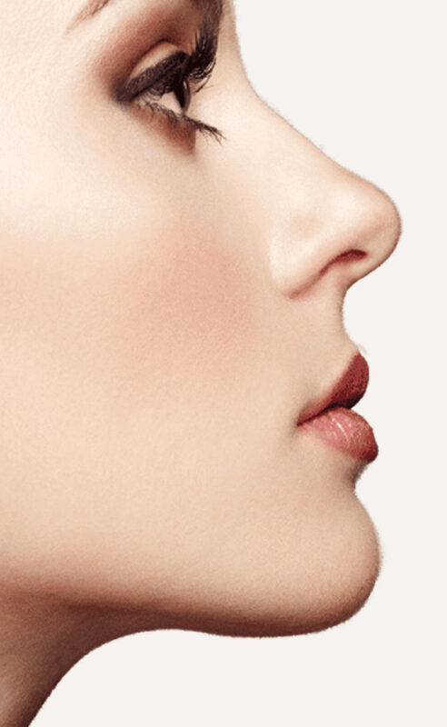 mini lifting facial Barcelona