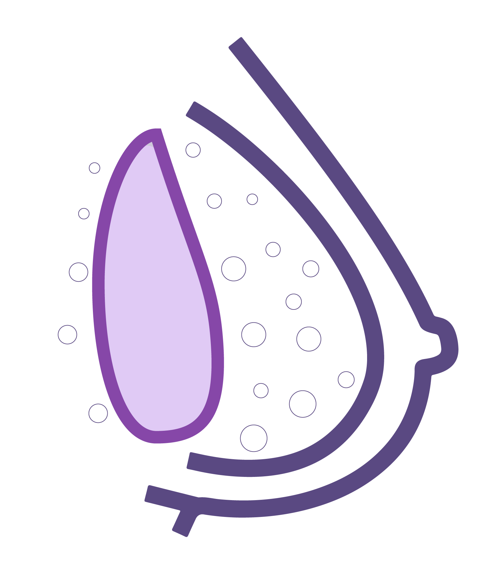 engrosamiento del tejido mamario que recubre el implante