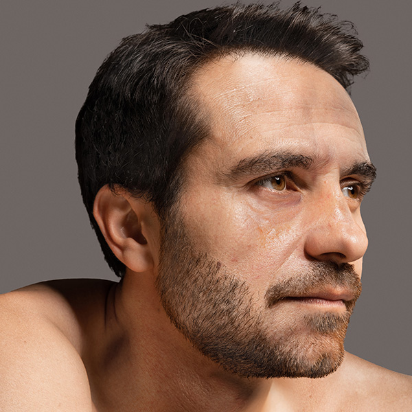 thermage facial antes