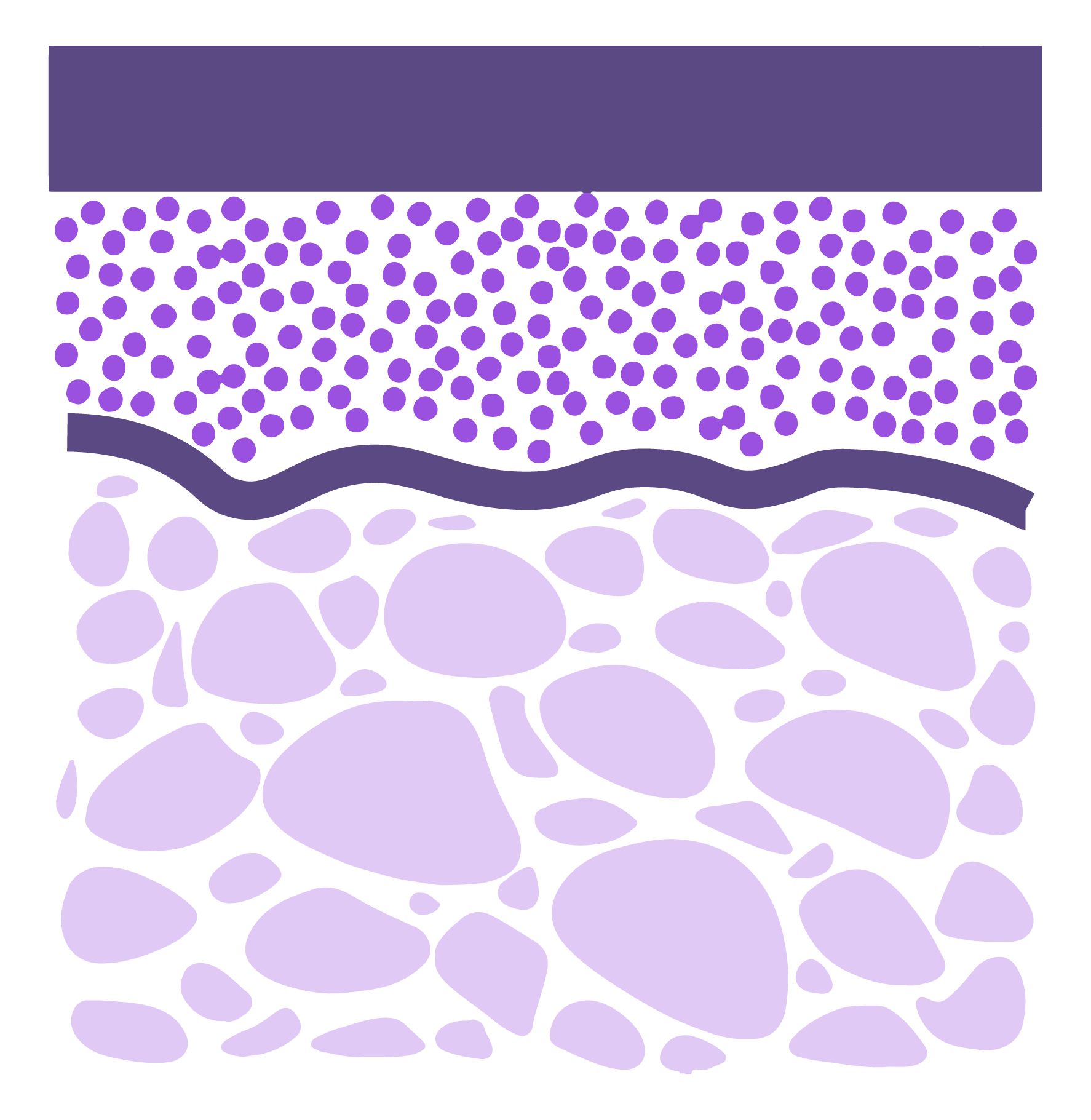 ácido poliláctico sculptra estimula la producción de colágeno